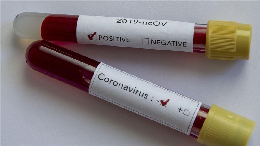 کروناویروس؛ از واهمه ها تا واقعیت ها ، آگاهی بیماری همه گیر را در هم می شکند