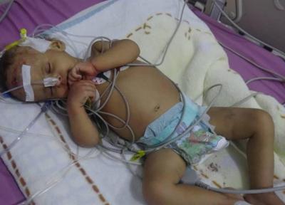 یمن، 27 میلیون یمنی با فاجعه روبرو هستند، کمبود شدید دارو و مراکز پزشکی